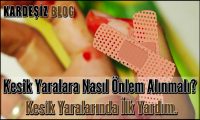 Kesik Yaralara Nasıl Önlem Alınmalı