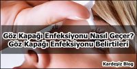 Göz Kapağı Enfeksiyonu Nasıl Geçer