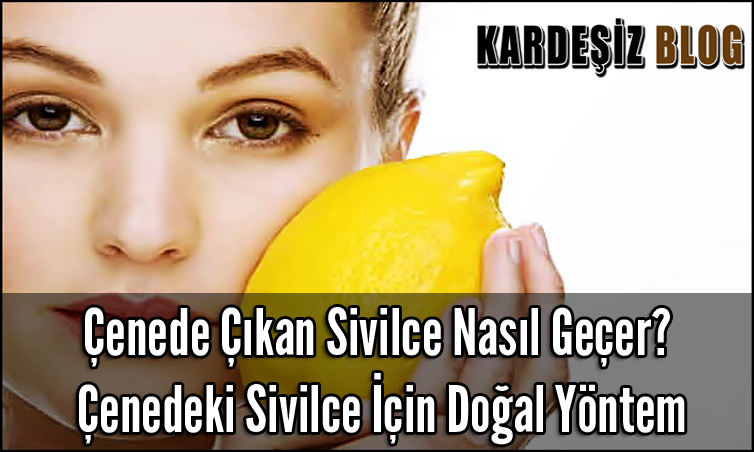 Çenede Çıkan Sivilce Nasıl Geçer