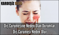 Diş Çürümesine Neden Olan Durumlar