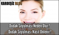 Dudak Soyulması Neden Olur