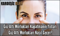 Göz Altı Morlukları Kapatmanın Yolları