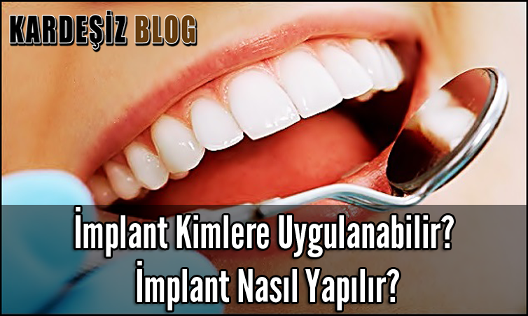 implant Kimlere Uygulanabilir