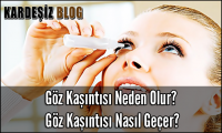 Göz Kaşıntısı Neden Olur