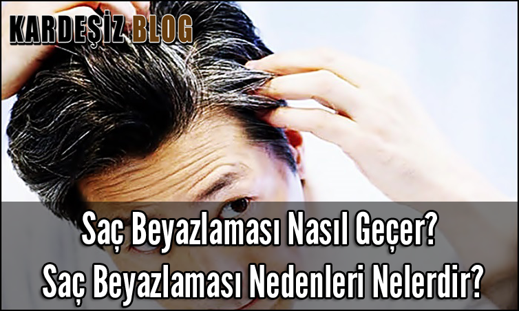 Saç Beyazlaması Nasıl Geçer