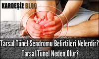 Tarsal Tünel Sendromu Belirtileri Nelerdir