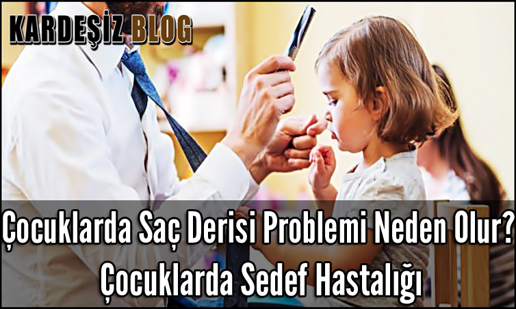 Çocuklarda Saç Derisi Problemi Neden Olur