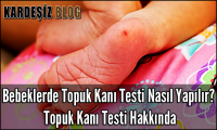 Bebeklerde Topuk Kanı Testi Nasıl Yapılır