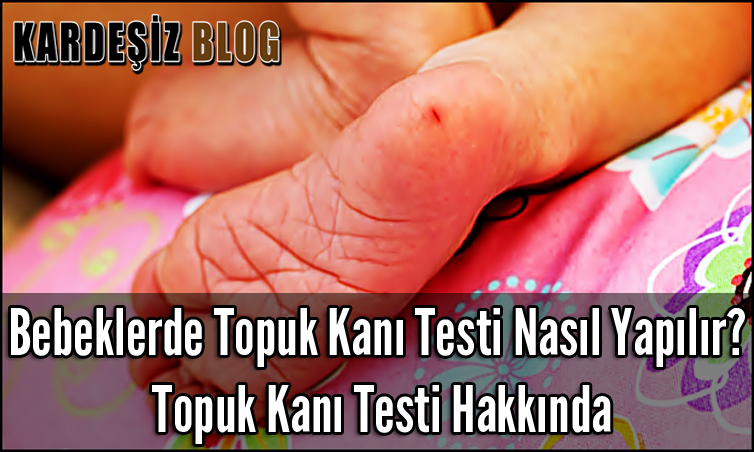 Bebeklerde Topuk Kanı Testi Nasıl Yapılır