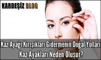 Kaz Ayağı Kırışıkları Gidermenin Doğal Yolları