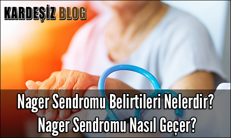 Nager Sendromu Belirtileri Nelerdir