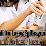 Alexandrite Lazer Epilasyon Nedir