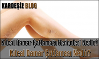 Kılcal Damar Çatlaması Nedenleri Nedir