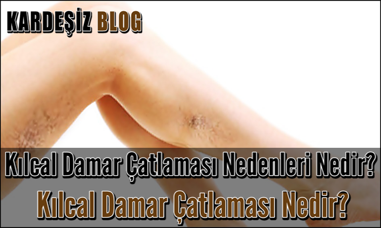 Kılcal Damar Çatlaması Nedenleri Nedir