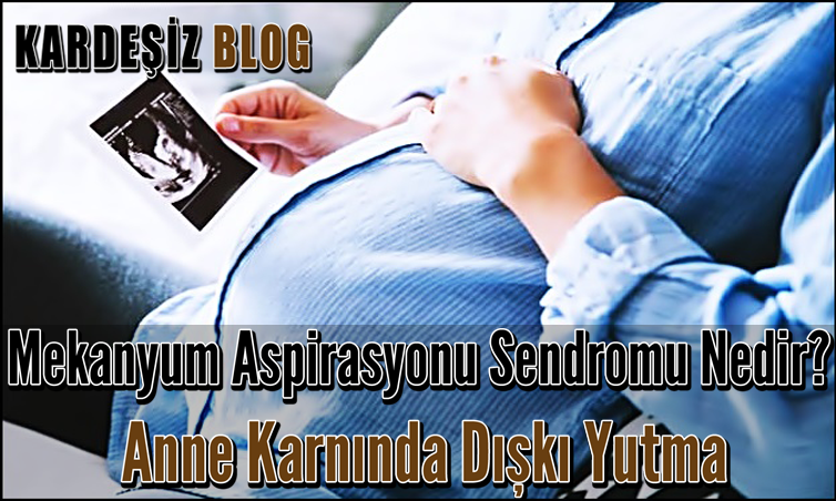 Mekanyum Aspirasyonu Sendromu Nedir