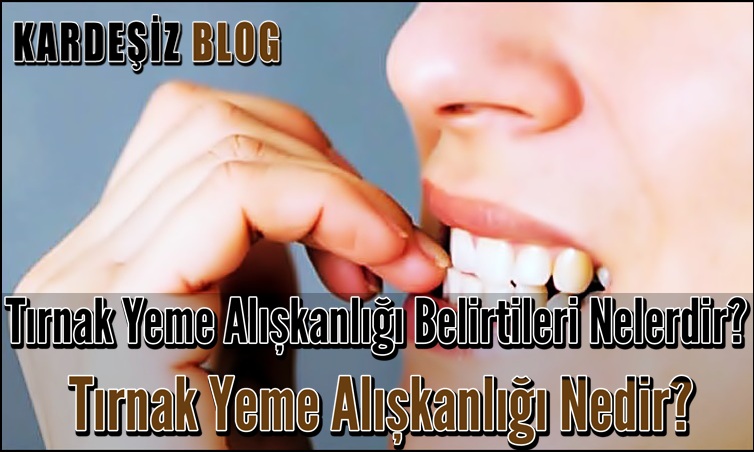 Tırnak Yeme Alışkanlığı Belirtileri Nelerdir