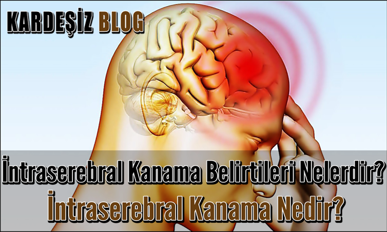 intraserebral Kanama Belirtileri Nelerdir