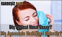 Diş Apsesi Nasıl Geçer