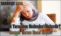 Damak Yarasının Nedenleri Nelerdir