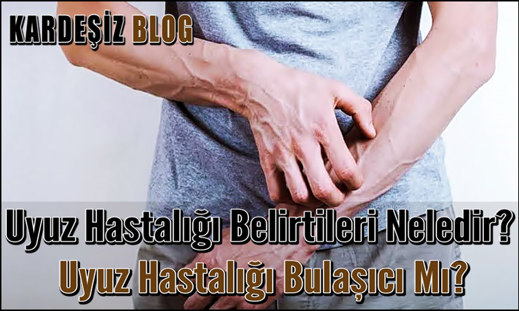 Uyuz Hastalığı Belirtileri Nelerdir