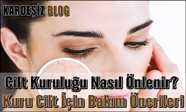 Cilt Kuruluğu Nasıl Önlenir