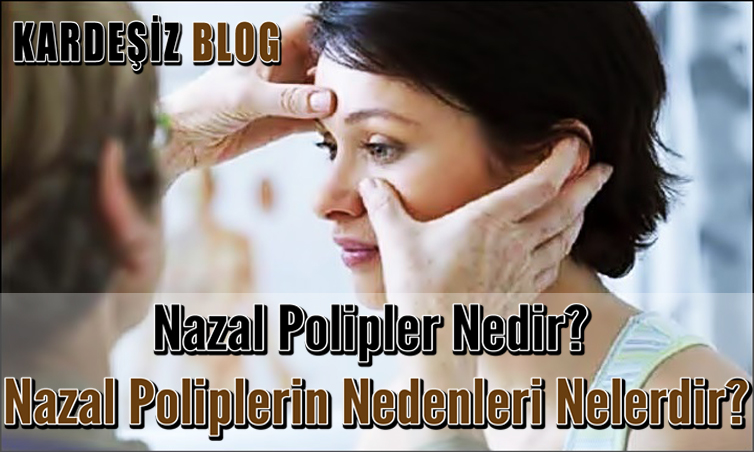 Nazal Polipler Nedir