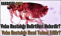 Veba Hastalığı Belirtileri Nelerdir