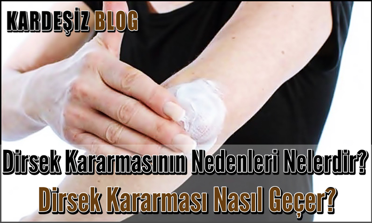 Dirsek Kararmasının Nedenleri Nelerdir