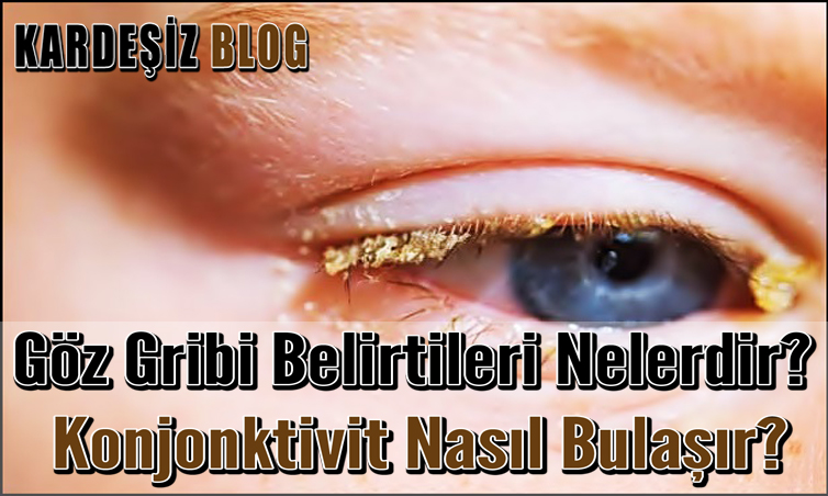 Göz Gribi Belirtileri Nelerdir