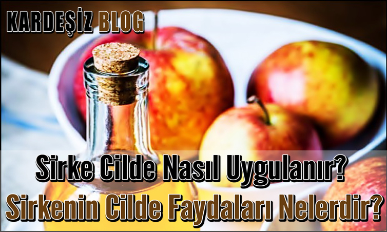 Sirke Cilde Nasıl Uygulanır