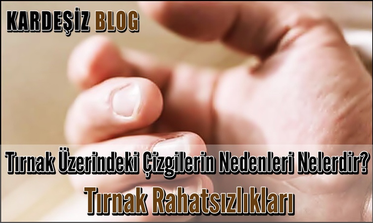 Tırnak Üzerindeki Çizgilerin Nedenleri Nelerdir