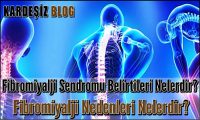 Fibromiyalji Sendromu Belirtileri Nelerdir