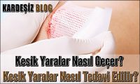 Kesik Yaralar Nasıl Geçer