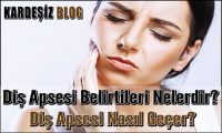 Diş Apsesi Belirtileri Nelerdir