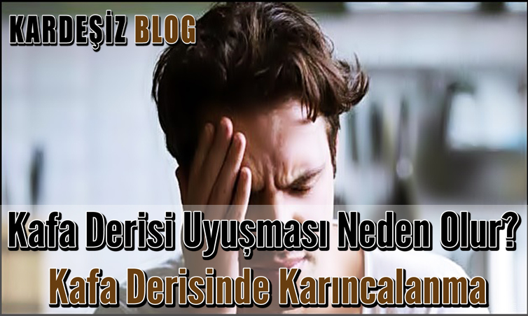 Kafa Derisi Uyuşması Neden Olur