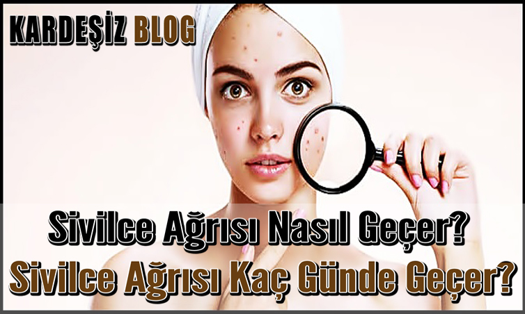 Sivilce Ağrısı Nasıl Geçer