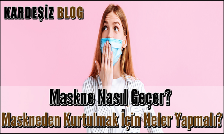 Maskne Nasıl Geçer