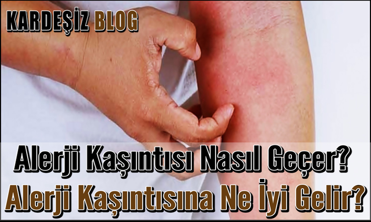 alerji kasintisi nasil gecer alerji kasintisina ne iyi gelir