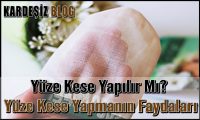 Yüze Kese Yapılır Mı