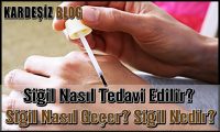 Siğil Nasıl Tedavi Edilir