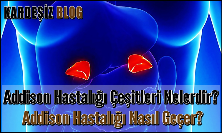 Addison Hastalığı Çeşitleri Nelerdir