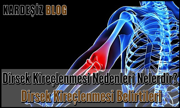 Dirsek Kireçlenmesi Nedenleri Nelerdir