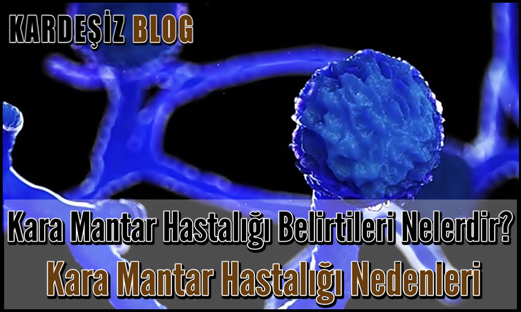 Kara Mantar Hastalığı Belirtileri Nelerdir