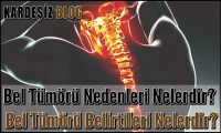 Bel Tümörü Nedenleri Nelerdir