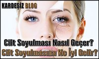 Cilt Soyulması Nasıl Geçer