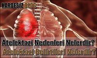 Atelektazi Nedenleri Nelerdir