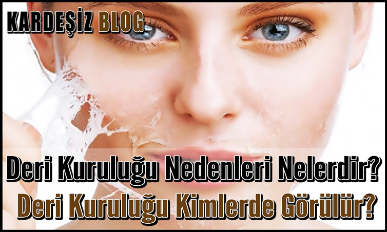 Deri Kuruluğu Nedenleri Nelerdir