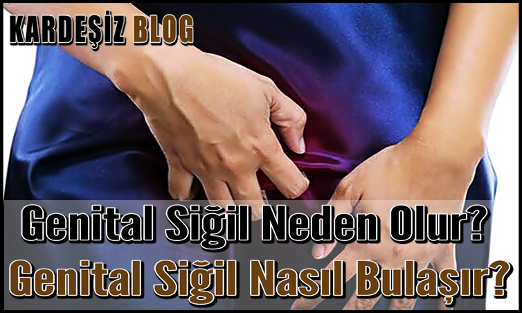 Genital Siğil Neden Olur