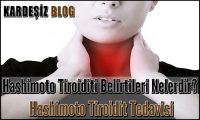 Hashimoto Tiroiditi Belirtileri Nelerdir