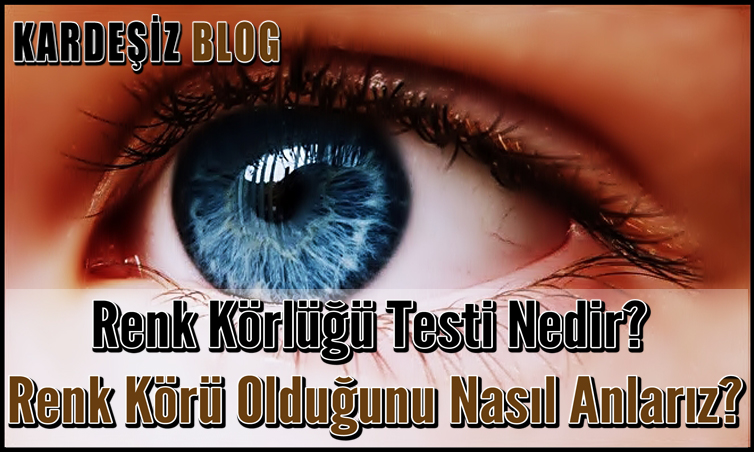 Renk Körlüğü Testi Nedir